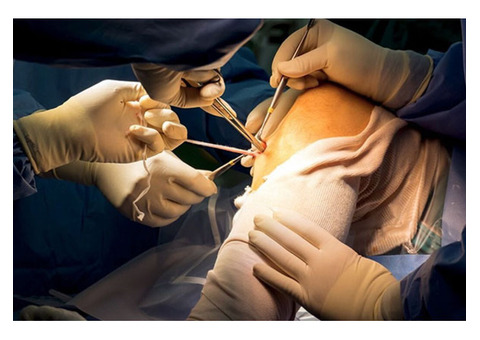 Trusted Arthroscopy Surgery in Jaipur