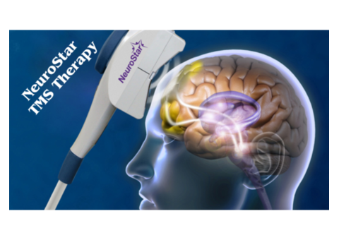 Best Neurostar TMS Therapy Minneapolis