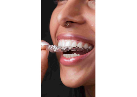 Benefits of Invisible Teeth Aligners for Teens