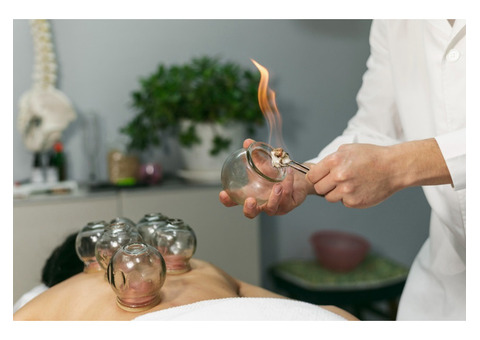 Relieve Pain Today with Cupping Therapy in London!