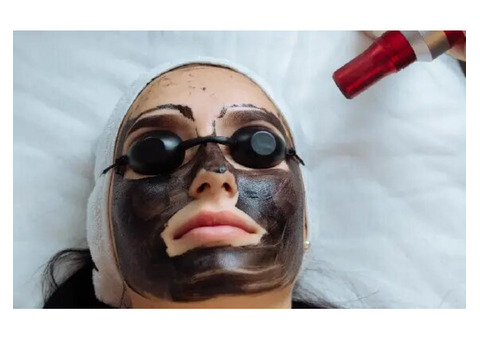 Carbon Peel Treatment in Delhi - The perfect solution to glowing skin