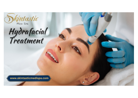 Perfect Hydrafacial in Riverside