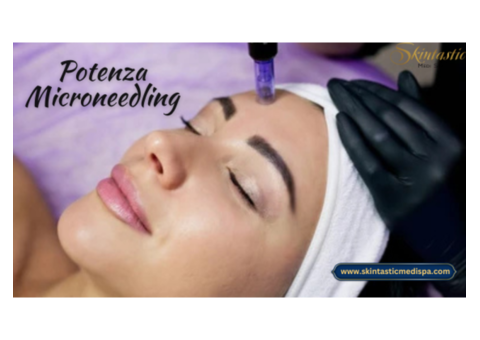 Advance Potenza Microneedling in Riverside