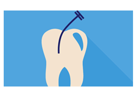 Affordable Root Canal Services by Experienced Dentists