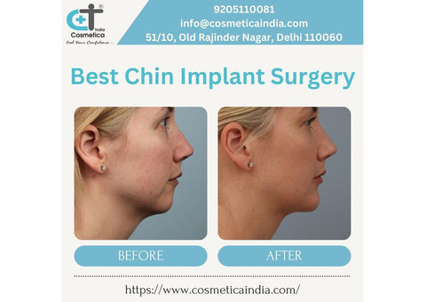 Chin Implant Surgery By Expert Cosmetic Surgeons