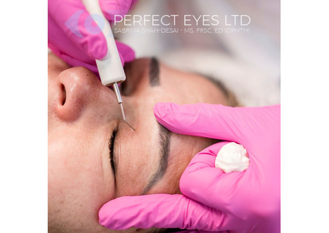 Revision Blepharoplasty in London, UK