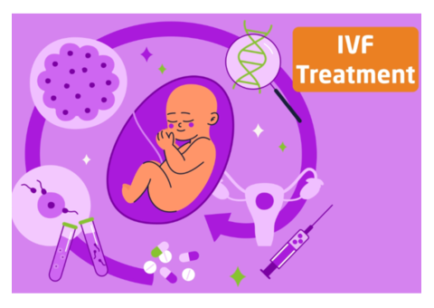 In Vitro Fertilization (IVF) at Pollin Fertility