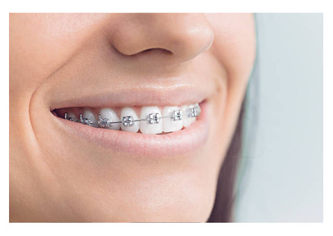 Transform Your Smile with Leading Orthodontics in Liverpool