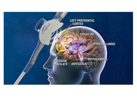 Mental Health Care with Neurostar TMS Therapy