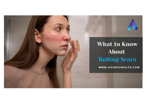 What to Know About Rolling Scars