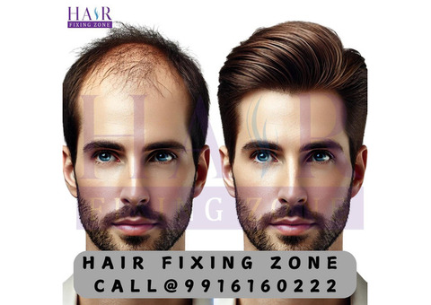 Non Surgical Hair Replacement In Sarjapur