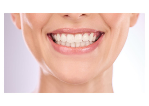 Transform Your Smile with Invisalign at The Colony's Trusted Dentist