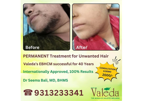 PERMANENT TREATMENT FOR UNWANTED HAIR VALEDA EBHCM