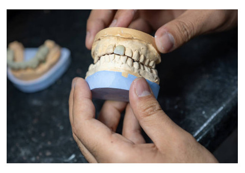 How CAD CAM Suppliers Ensure Accuracy in Dental Prosthetics