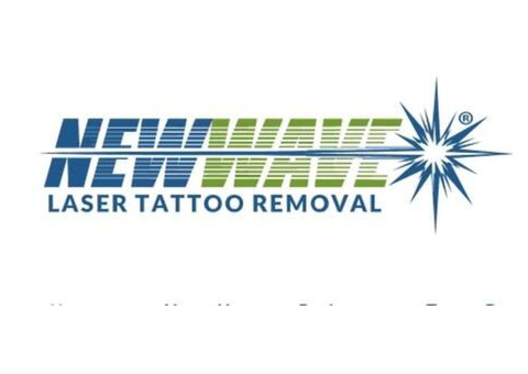 New Wave Laser Tattoo Removal | Laser Tattoo Removal Bethlehem