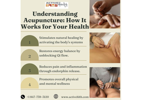 How to Choose the Right Acupuncturist for You