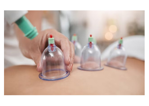 Cupping Therapy: Natural Healing for Pain & Relaxation