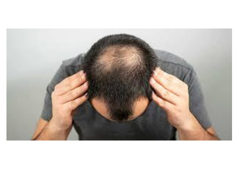 QHT Clinic: The Top Hair Transplant Clinic in India