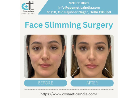 Buccal Fat Removal Surgery