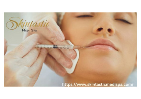 Transform Your Smile with Lip Fillers Riverside