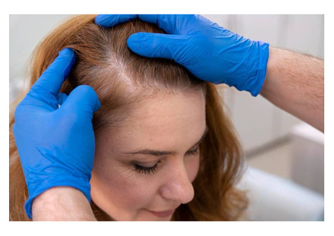 Non- Surgical Hair Replacement Dallas