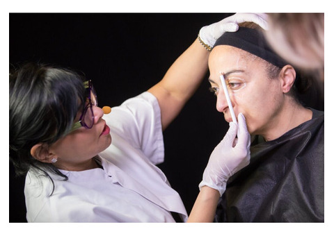 Brow lift Surgery in London, UK