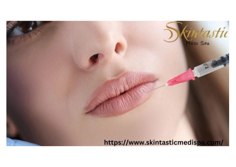 Enhance Your Smile with Lip Fillers Riverside at Skintastic