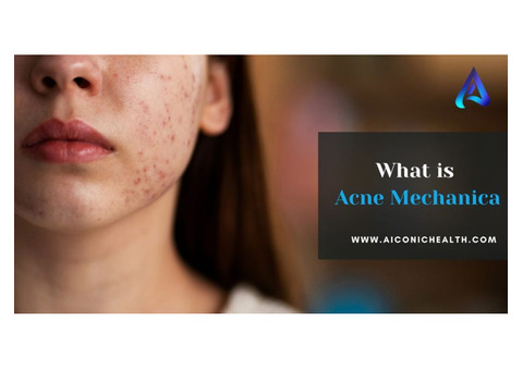 What is Acne Mechanica?