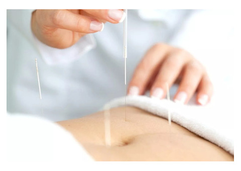 Best Fertility Acupuncture NYC