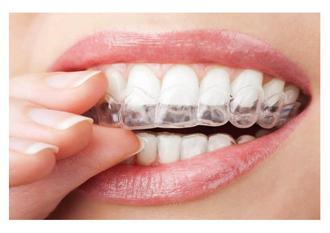 Make Your Smile Perfect with Aligners in Mumbai