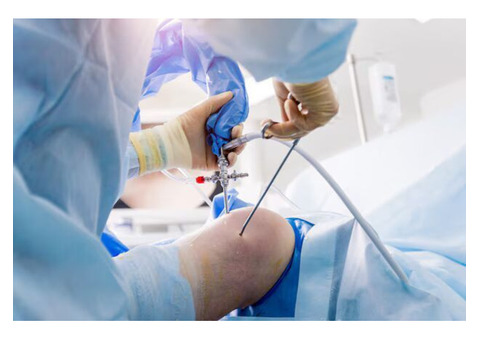 Top-Quality Arthroscopy Surgery in Dubai