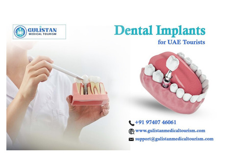 Bangalore’s Trusted Dental Implant Services for UAE Tourists