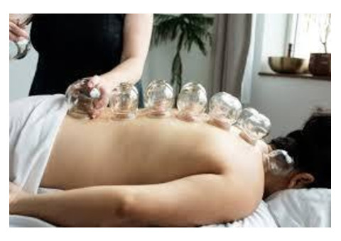 Acupuncture Treatment in Thornhill: Holistic Healing for Pain Relief