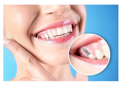 Oral Rehabilitation in Miami, FL – Restore and Renew Your Smile!