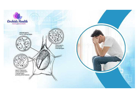 Best Azoospermia Treatment in Bangalore - Orchidz Health