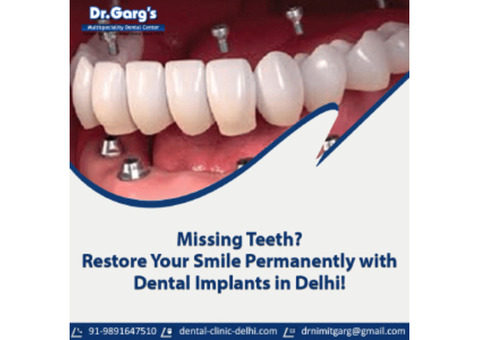 Restore Your Smile Permanently with Dental Implants in Delhi!