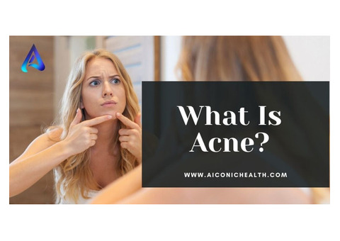 Understanding Acne: Causes and Solutions