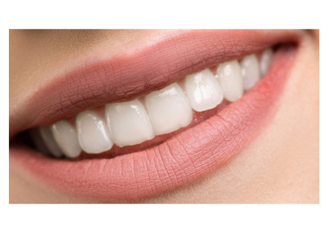 Straighten Your Teeth with Ease: Invisalign Services in Lewisville