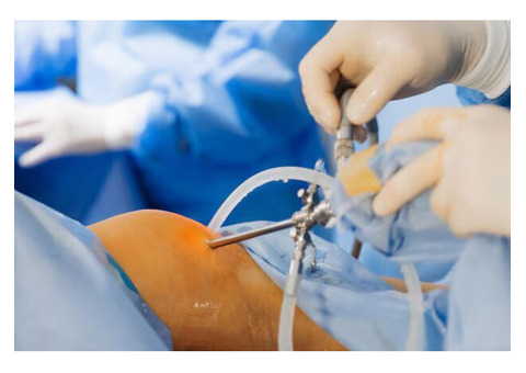 Advanced Solutions for ACL Ligament Surgery in Haryana