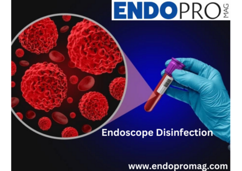 Advanced Endoscope Disinfection with Endopromagin