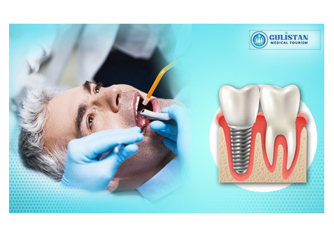 Dental Implants in Bangalore – Gulistan Medical Tourism