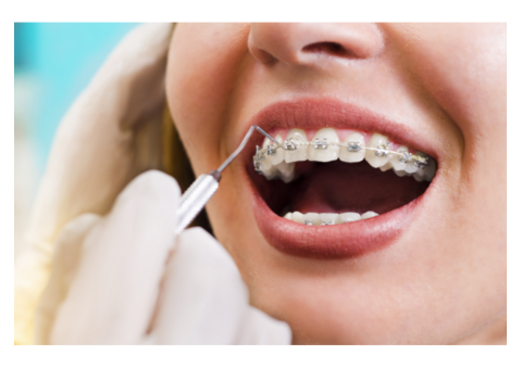 Transform Your Smile with Expert Orthodontic Care at Pesh Orthodontics