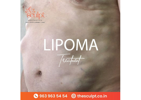 Lipoma Treatment Hyderabad