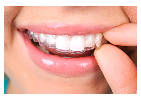 Clear Aligners for Complex Orthodontic Cases