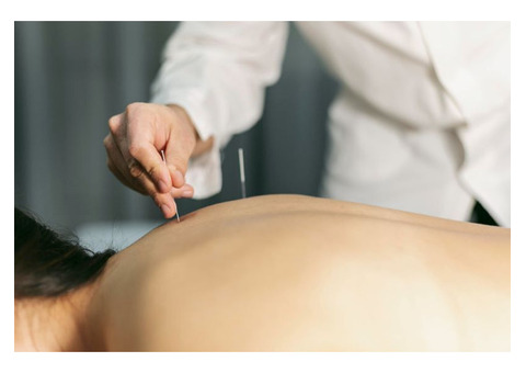 Say Goodbye to Back Pain with Professional Acupuncture!