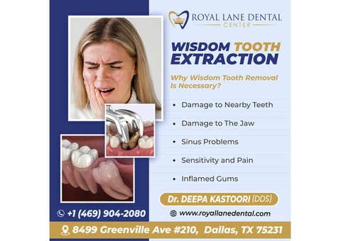 Wisdom Teeth Removal in Dallas