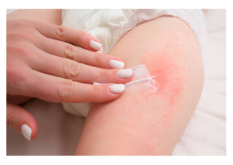 How can I find the best eczema treatment for sensitive skin?