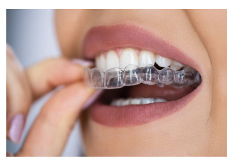 How Invisible Aligners Work