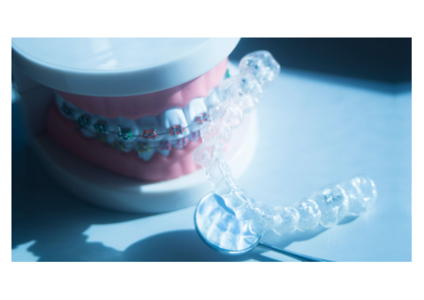 Invisalign Dental Braces in Menifee: Pesh Orthodontics