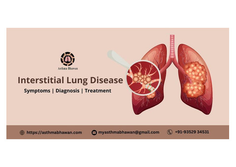 Best Doctor For Interstitial Lung Disease Treatment In Jaipur